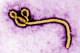 Worm-like Ebola virus particle