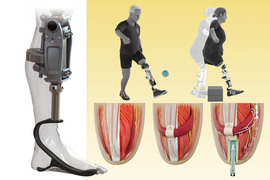 Renderings of the bionic knee, three steps to attaching the knee prosthetic, a person playing soccer with a prosthetic leg, and a person jumping over a box with prosthetic legs.