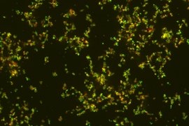 Nanoparticles, in green, targeting bacteria, shown in red.