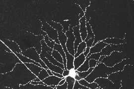 This image, taken with a light microscope, shows the body and many branching dendrites of a retinal ganglion cell.
