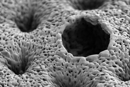 Pictured is a scanning electron micrograph of a porous, nanostructured poly(lactic-co-glycolic acid) (PLGA) membrane. The membrane is coated with a polyelectrolyte (PEM) multilayer coating that releases growth factors to promote bone repair.