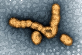 Colorized transmission electron micrograph showing H1N1 influenza virus particles. 