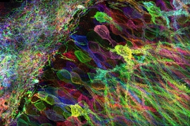 MIT researchers have developed a new way to image proteins and RNA inside neurons of intact brain tissue. 

