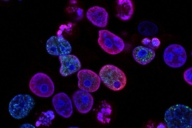 Human colorectal cancer cells
