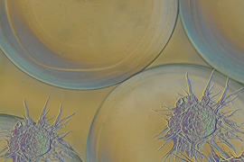 The immune system often builds up a wall of dense scar tissue around implanted medical devices, a process known as fibrosis. The cell shown in blue represents a macrophage that has been blocked from initiating fibrosis.
