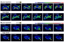 Researchers have developed a metal-free contrast agent for MRI scans, which could be safer for certain patients.
