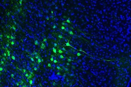 The dorsal hippocampus receives spatial and temporal information from an upstream brain region known as the medial entorhinal cortex (MEC). Green staining shows MEC engram cells, which store a long-term fear memory and have the light sensitive optogenetic protein channelrhodopsin-2. Blue staining shows all cells in the MEC brain region, including non-engram cells (blue color staining only). 
