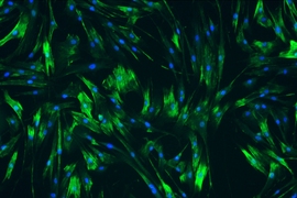MIT engineers used human ureteral smooth muscle cells grown in a lab dish to identify drugs that would help to relax the muscle cells.