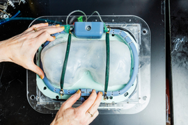 The blue-rimmed ventilator is held down. It has an inflated, bag-like interior with two green cables running over it.