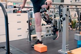 A person on a treadmill uses their new leg prosthesis to walk over a foam block.