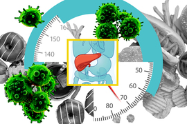 High-fat foods, sections of a bathroom scale, and cancer cells around an image of a liver