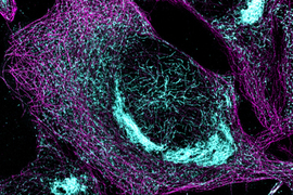 Colorized microscopic image