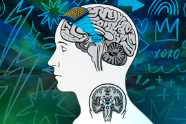 A grid-like patch sits on top of a human head. It sends blue light to a tiny part of the brain.