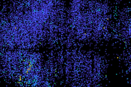Micrograph showing electrical activity of neurons