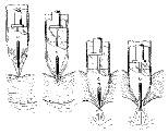 This diagram from Professor Blanco's trocar patent application shows the progression of his trocar as it pierces the skin during endoscopic surgery. At the moment the sharp point perforates through the skin (third image), the safety guard has already fully deployed, protecting internal organs. A puff of CO2 further safeguards the organs by gently blowing them out of reach.