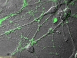The peptide scaffold structure is analyzed by scanning electron microscopy (magnification 60,000X). Higher magnification reveals interwoven sapeptide nanofibers that are approximately 10-20nm in diameter.