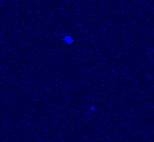 A Chandra image of neutron star KS 1731-260, remarkably cool after 12 years of being bombarded with hot gas from a companion star, not visible here. The now dim KS 1731-260 is the light blue object slightly above the midline of this image.