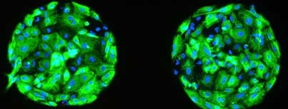Human embryonic stem cells were coaxed to differentiate into epithelial (skin) cells atop the two spots of biomaterial shown here. Cytokeratin (a marker of epithelial cells) is stained green; cell nuclei are blue.