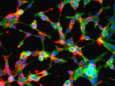 This image shows prostate cancer cells that have taken up fluorescently labeled nanoparticles (shown in red). The cells' nuclei and cytoskeletons are stained blue and green, respectively. Similarly designed targeted nanoparticles are capable of getting inside cancer cells and releasing lethal doses of chemotherapeutic drugs to eradicate tumors.