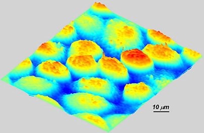Epithelial cancer cells as seen by quantitative phase imaging.