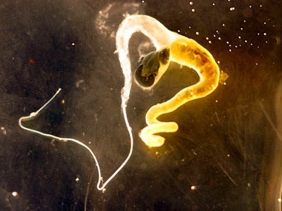 The golden silk spider produces its silk in the ampullate gland, shown here.