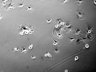 MIT researchers have discovered that treating bone marrow stem cells with a growth factor called EGF promotes their survival and growth when the EGF is tethered to a scaffold. This image shows stem cells with no EGF treatment. <a onclick="MM_openBrWindow('stem-cells-1-enlarged.html','','width=509, height=583')">
<span onmouseover="this.className='cursorChange';">Open image gallery</span>
</a>
<...