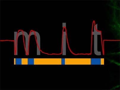 MIT is spelled out by neuronal voltage, with yellow light inducing downward neural deflections, and blue light inducing upward neural deflections. Such unprecedented, precise programming of neuronal activity is now possible due to efforts of MIT scientists.