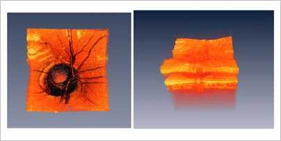 Images of the human optic nerve head. Comparison of surface appearance (left) versus three dimensional optical coherence tomography (OCT) imaging requires extremely fast measurement speeds because 3D data sets are large. 3D OCT data can be processed to visualize the detailed internal structure of the retina. These technologies can detect subtle changes in the retina which indicates early stage dis...