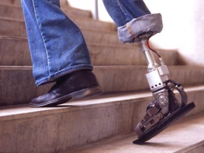 The MIT Media Lab's powered ankle-foot prosthesis in action.