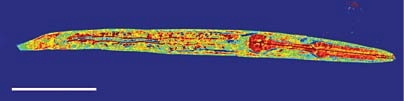 A 3D image of the nematode C. elegans, taken using a new imaging technique developed at MIT. The scale bar (lower left) is 50 micrometers.