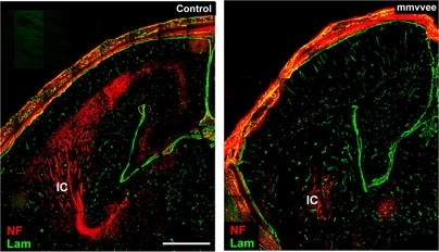 This image of axons in a mouse embryo was taken after 16.5 days of gestation. In a normal mouse, left, axons (red) extend from the cortex upwards towards a part of the brain known as the internal capsule. In a mouse lacking Ena/VASP proteins, the axons fail to grow.
