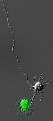 Two neurons, one normal (top) and one lacking the Ena/VASP proteins. After being cultured for 48 hours, the normal one has extended an axon and many dendrites, while the mutated neuron fails to make such extensions.