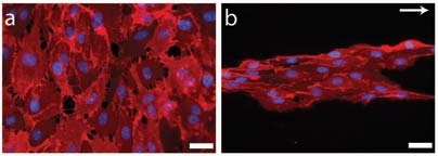 When endothelial progenitor cells are grown on a nanopatterned substrate, they align in the direction of the pattern (right). At left are cells grown on a flat surface.