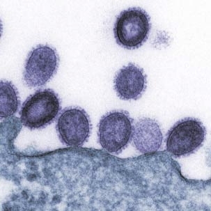 Transmission electron micrograph of avian influenza A H5N1 viruses (purple) released from infected human cell (blue).