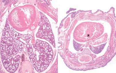 On the left is an image of the lungs of a normal mouse. On the right are the lungs of a mouse in which a family of microRNA genes have been knocked out. The lungs fail to develop normally, and the mice die soon after birth.