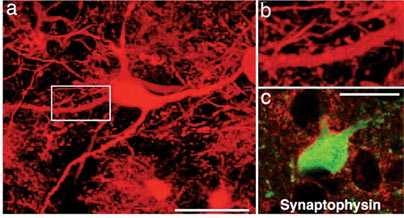 In this magnified image from the PNAS paper, a nerve cell derived from artificially created stem cells is shown after its integration in an animal brain.