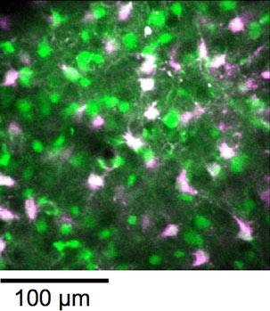 A field of neurons (green) and astrocytes(purple) within visual cortex, visualized by high-resolution two-photon imaging in the intact brain. The astrocytesare labeled with the marker dye SR101, and both neurons and astrocytesare subsequently labeled with the calcium indicator OGB1.