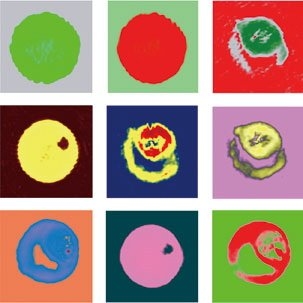 Human red blood cells (RBCs) invaded by Plasmodium falciparum. Three dimensional maps of the refractive index and nanoscale cell membrane fluctuations of infected human RBCs were constructed at different maturation stages of the parasite's by two non-invasive optical techniques: Tomographic Phase Microscopy and Diffraction Phase Microscopy. Color added for visualization.