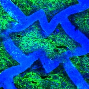 Confocal micrograph of an accordion-like honeycomb scaffold with cultured rat heart cells (scaffold is colored blue; seeded, living heart cells are colored green with blue nuclei). Original magnification = 250X.
