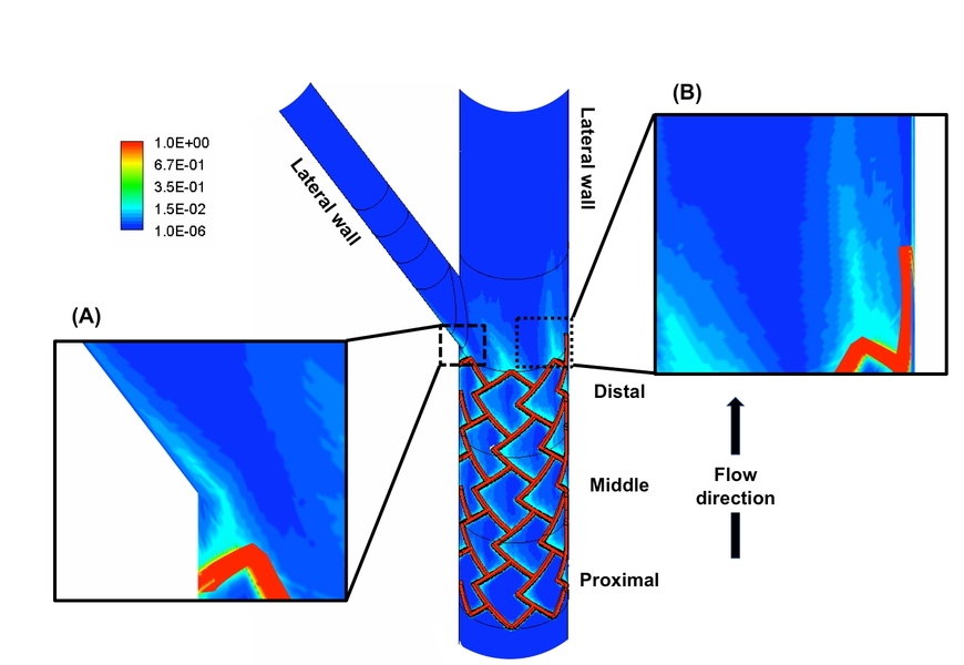 Increased drug deposition along the flow direction on the lateral walls of the bifurcating vessel. Insets show high magnification images of drug pattern on the lateral wall (A) of the side-branch and opposite to the flow divider (B), respectively.