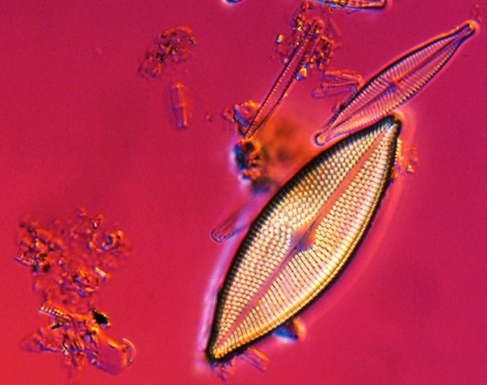 An image of diatoms, a major group of eukaryotic algae that are one of the most common types of phytoplankton.