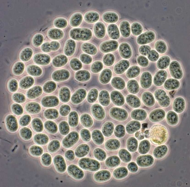 A colony of cyanobacteria