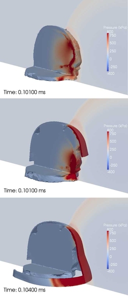 These images show the pressure waves that are transmitted to the brain tissue for the three simulation scenarios considered by Radovitzsky’s team: unprotected head (top), head with helmet (middle), and head with helmet and face shield (bottom). The face shield clearly prevents the direct transmission of blast energy into the brain.