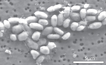 The bacteria GFAJ-1, shown here, can thrive on arsenic — a discovery that upends long-held assumptions about the basis of life here on Earth and elsewhere.