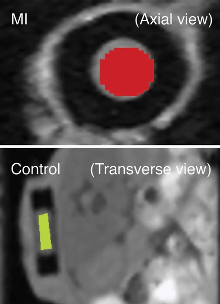 A scanned version of the implantable device.