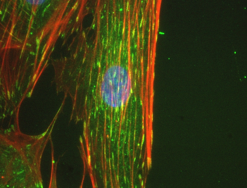 Proteins (actin, red and vinculin, green) inside adult bone marrow-derived stem cells that were grown in the lab for three days, with the 'crowder' particles.
