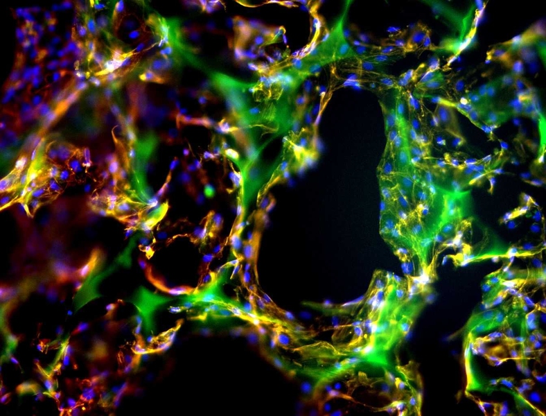 This image shows endothelial cells on three-dimensional scaffolds: the scaffold is in green, the cells in red and the nucleus in blue.