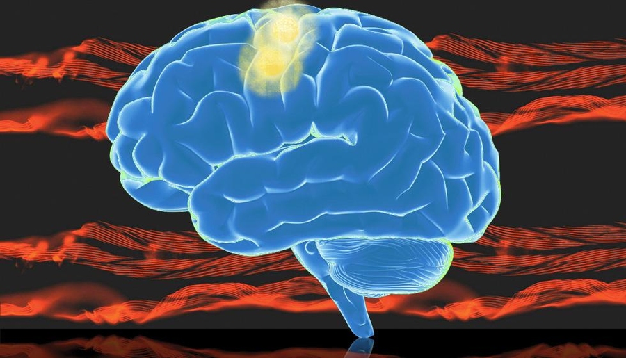 This graphic shows the brain, with the motor cortex highlighted in yellow.