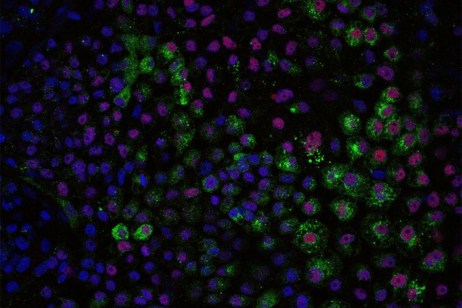 Early liver cells