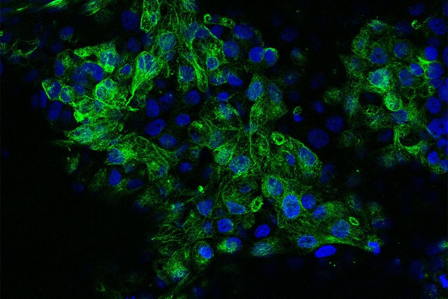 Cells stained for tubulin